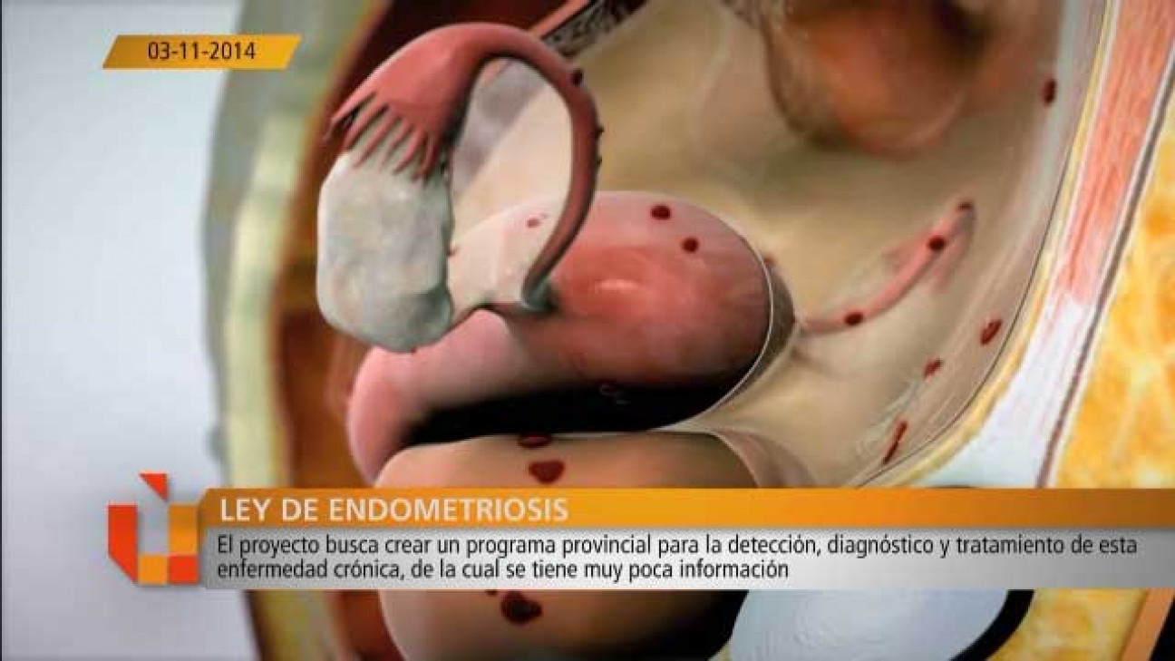 imagen Lorena Meschini sobre la Ley de Endometriosis