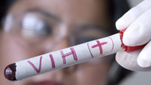 imagen Habilitaron testeos rápidos de VIH en Ciencias Médicas